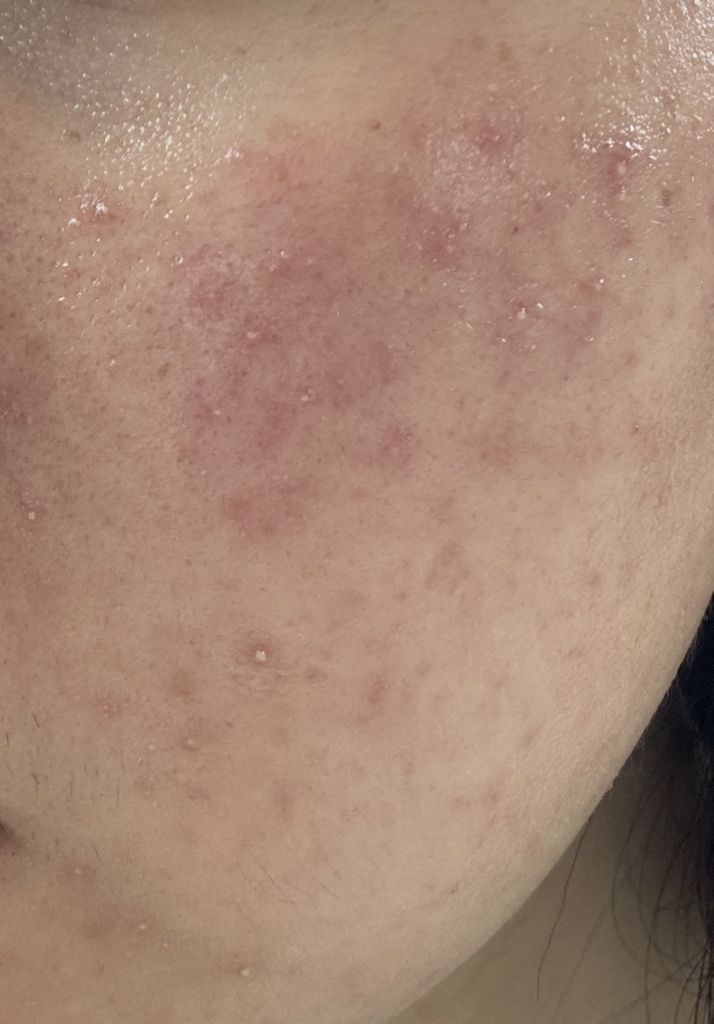 桑特医生 阿朱伦润肤乳 common.review image