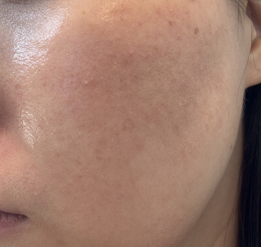 桑特医生 阿朱伦润肤乳 common.review image