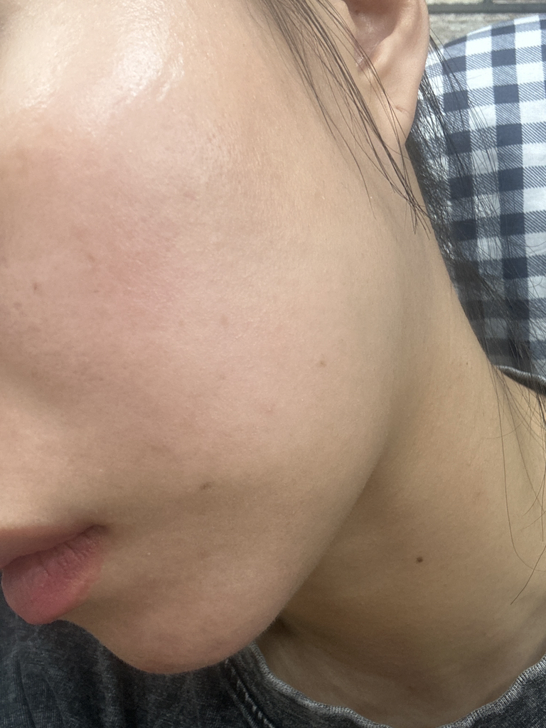 红色去痕霜 2.0的真实用户使用照片