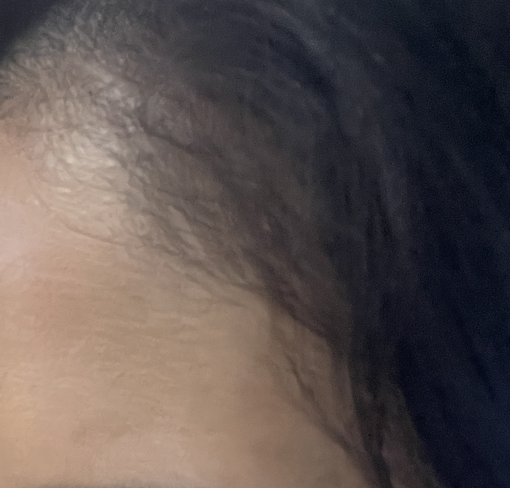 리필드 (Refilled) 사이토카인 부스터 [프로] review image