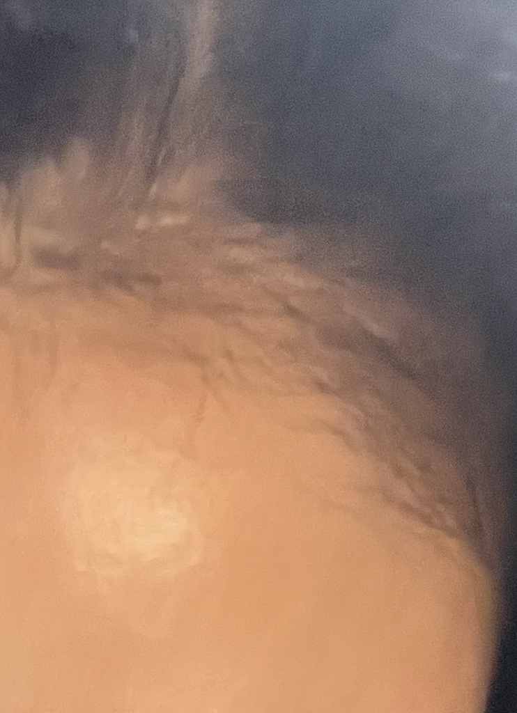 리필드 (Refilled) 사이토카인 부스터 [프로] review image