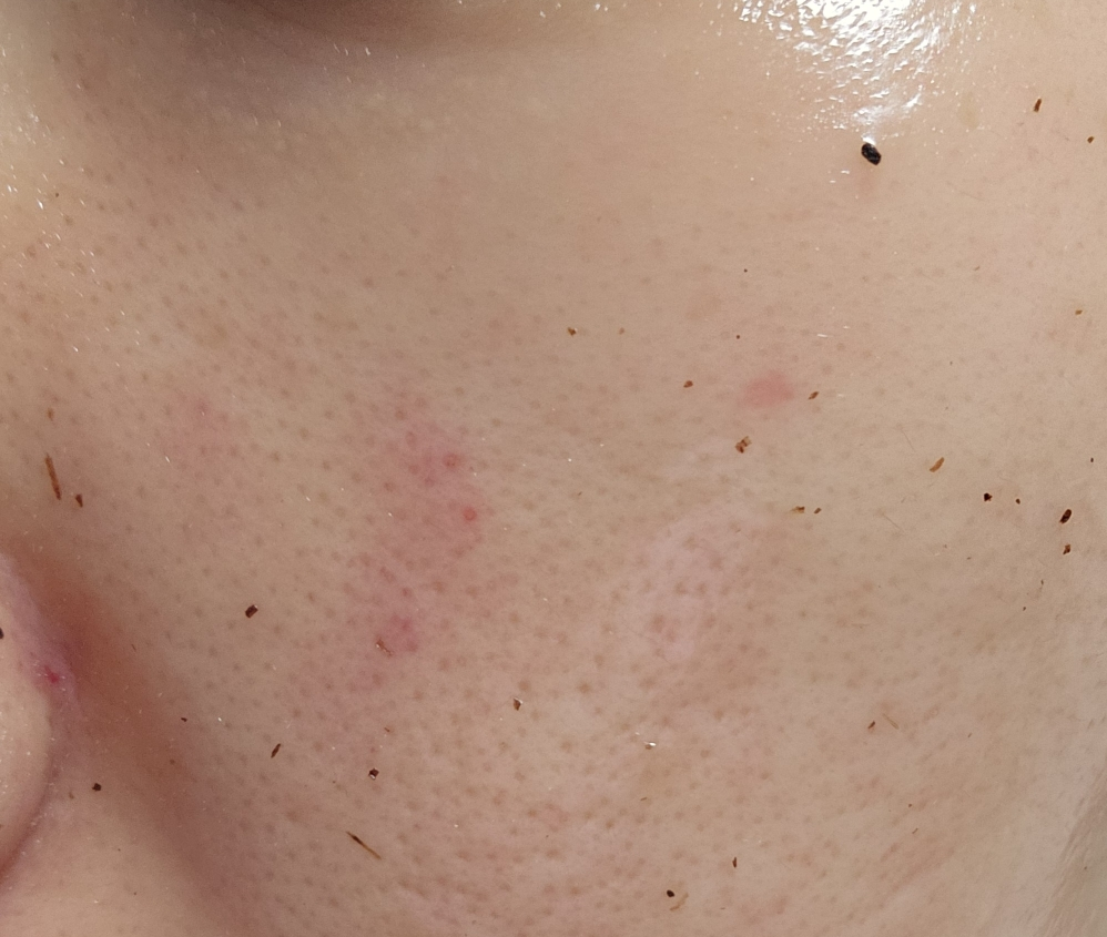 메디필 (MEDIPEEL) 시카 쿨링 진정 랩핑 마스크 review image