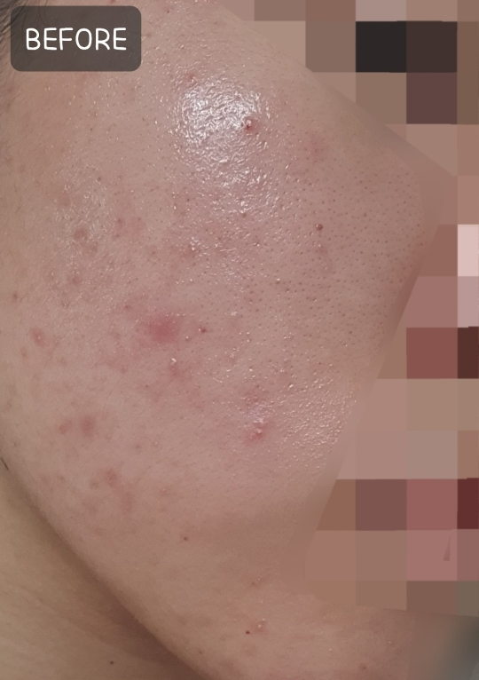 어나더페이스 (ANOTHERFACE) 나이아치온 빛 겔 마스크 review image