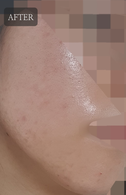 어나더페이스 (ANOTHERFACE) 나이아치온 빛 겔 마스크 review image