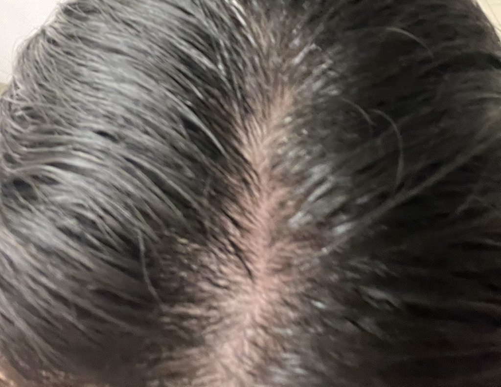 리필드 (Refilled) 사이토카인 부스터 [프로] review image