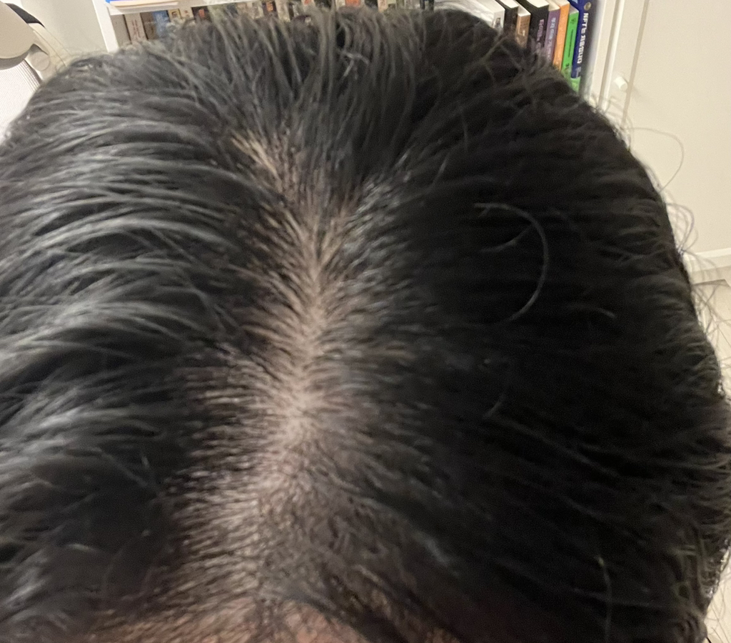 리필드 (Refilled) 사이토카인 부스터 [프로] review image