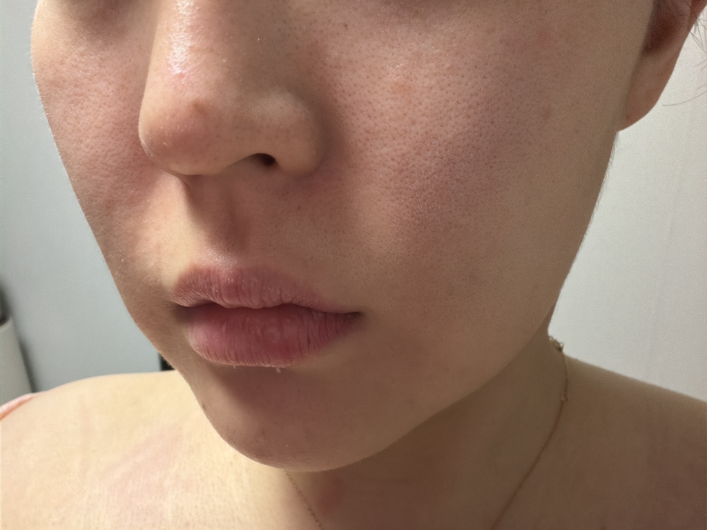 鸡蛋爽肤水作为 4 号毛孔清洁剂的真实用户使用照片