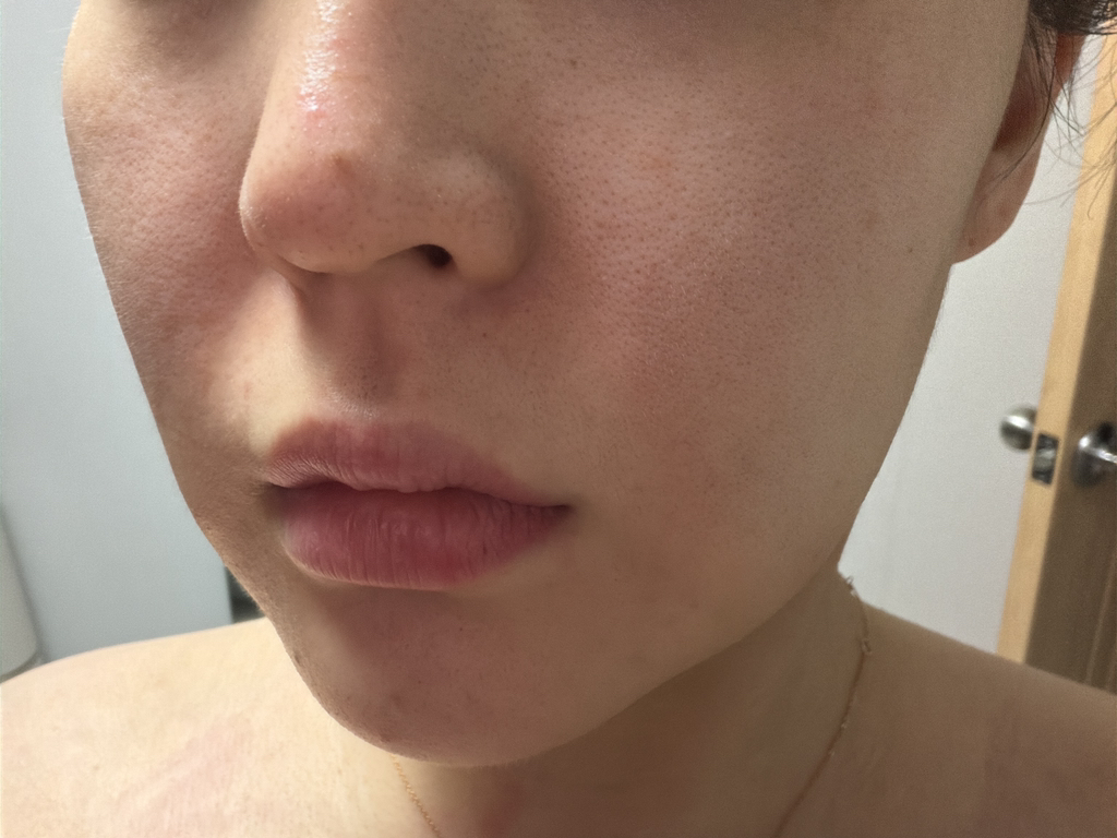 鸡蛋爽肤水作为 4 号毛孔清洁剂的真实用户使用照片