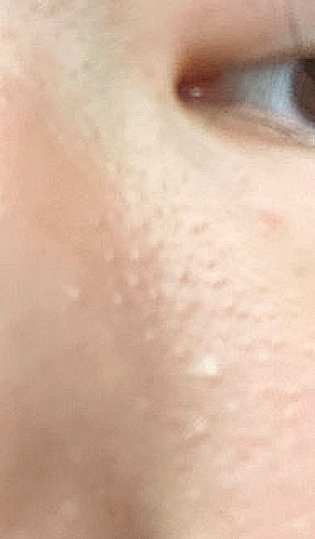 MEDIFAULT PhytoGenPhil 安瓿瓶 common.review image
