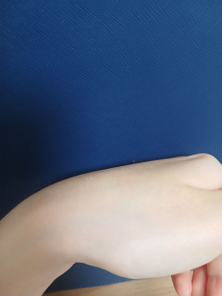 Ảnh đánh giá thực tế của người dùng về Acne Doctor 1st Speedy Spot