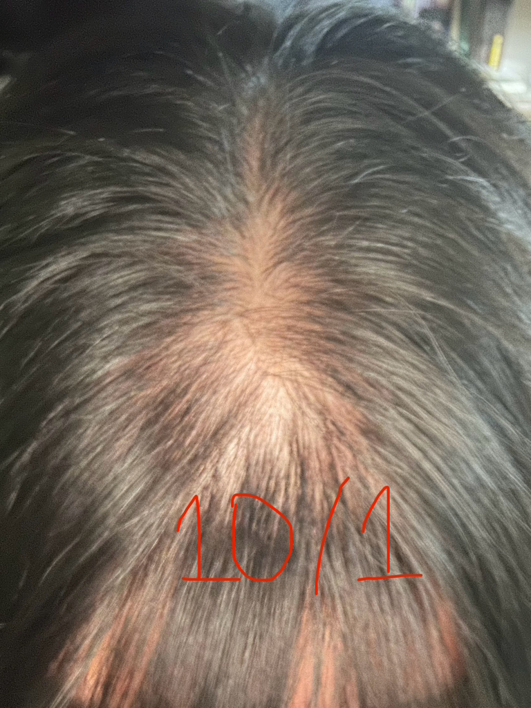 릴리이브 (lilyeve) 그로우턴 앰플 review image