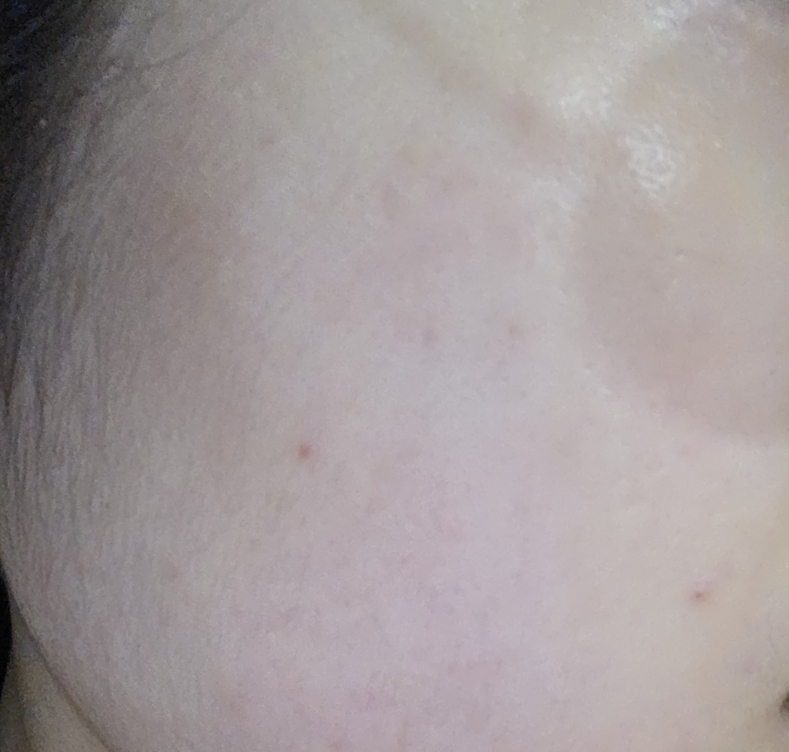 브링그린 (BRINGGREEN) 블루빈 B5-PDRN 마일드 로션 review image