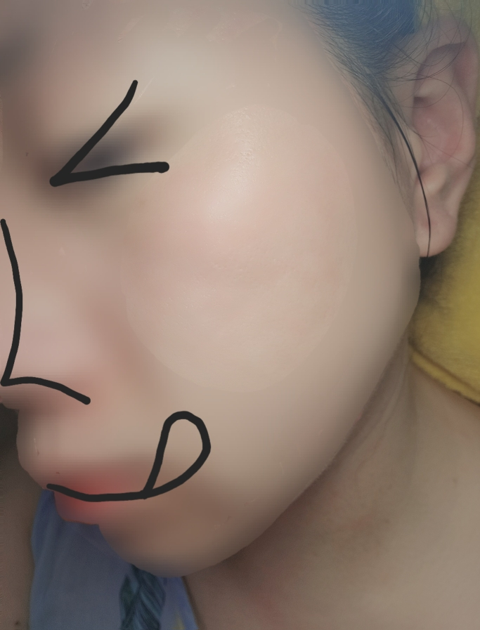 브링그린 (BRINGGREEN) 블루빈 B5-PDRN 마일드 로션 review image