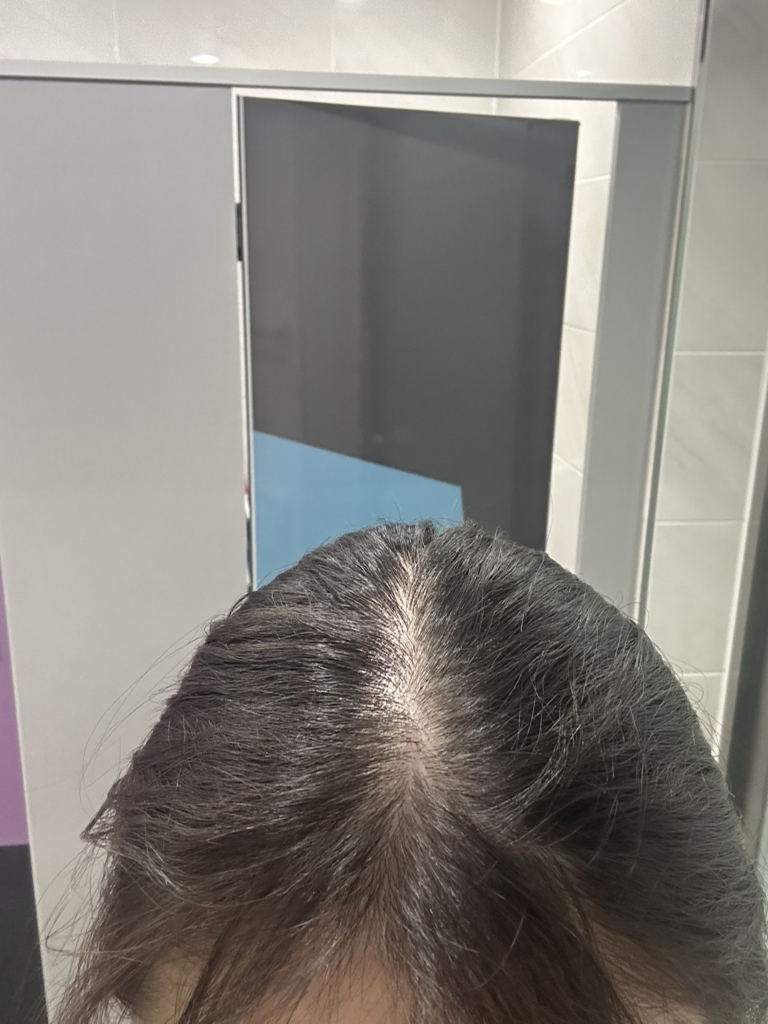 细胞因子促进剂 [Pro］的真实用户使用照片