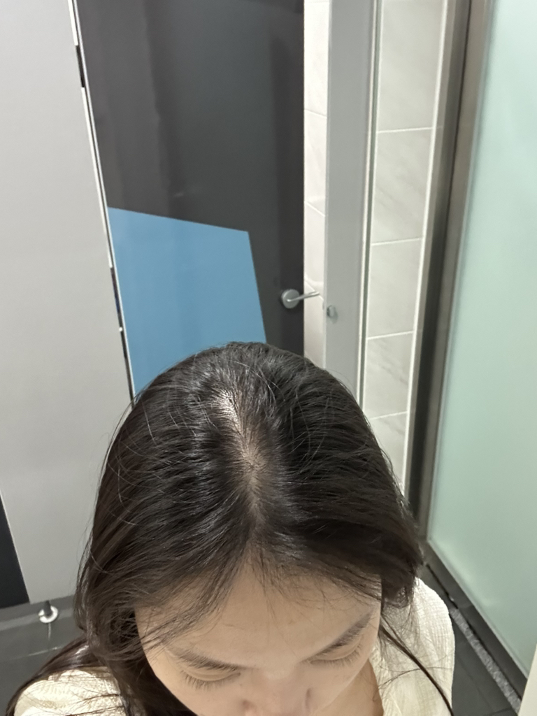 细胞因子促进剂 [Pro］的真实用户使用照片