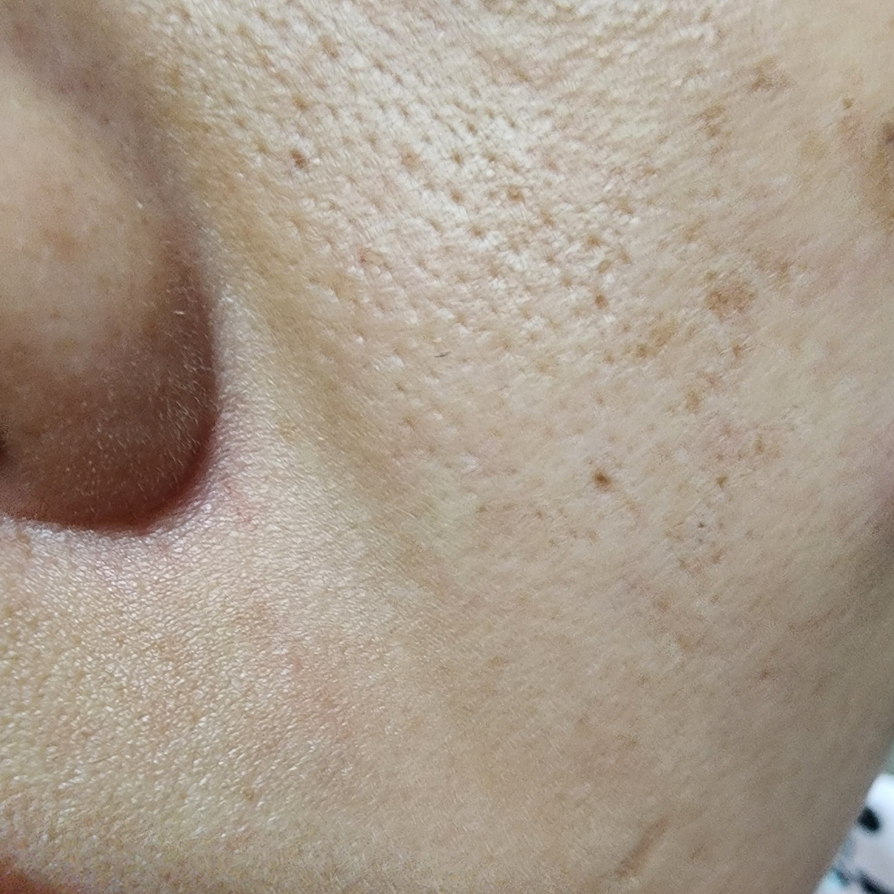 보나메두사 (bonamedusa) 워터 오렌지 스킨 딜리트 review image