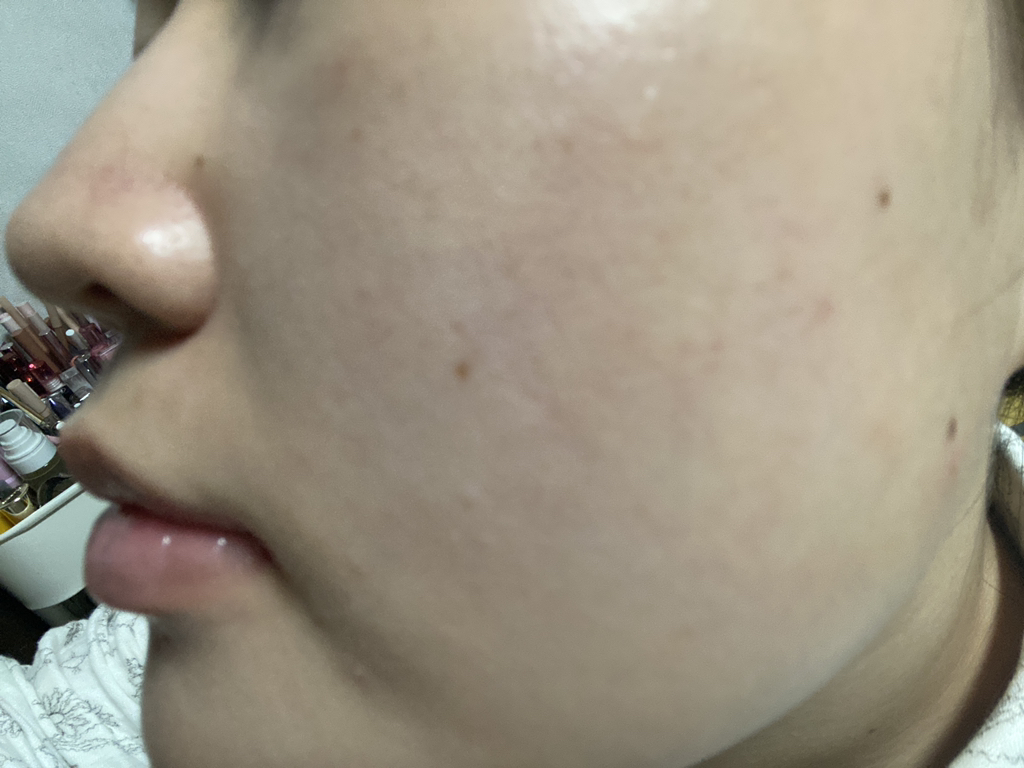 白色发光安瓿面膜的真实用户使用照片