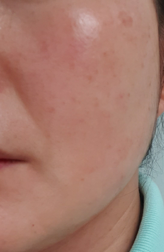 荷荷巴油的真实用户使用照片