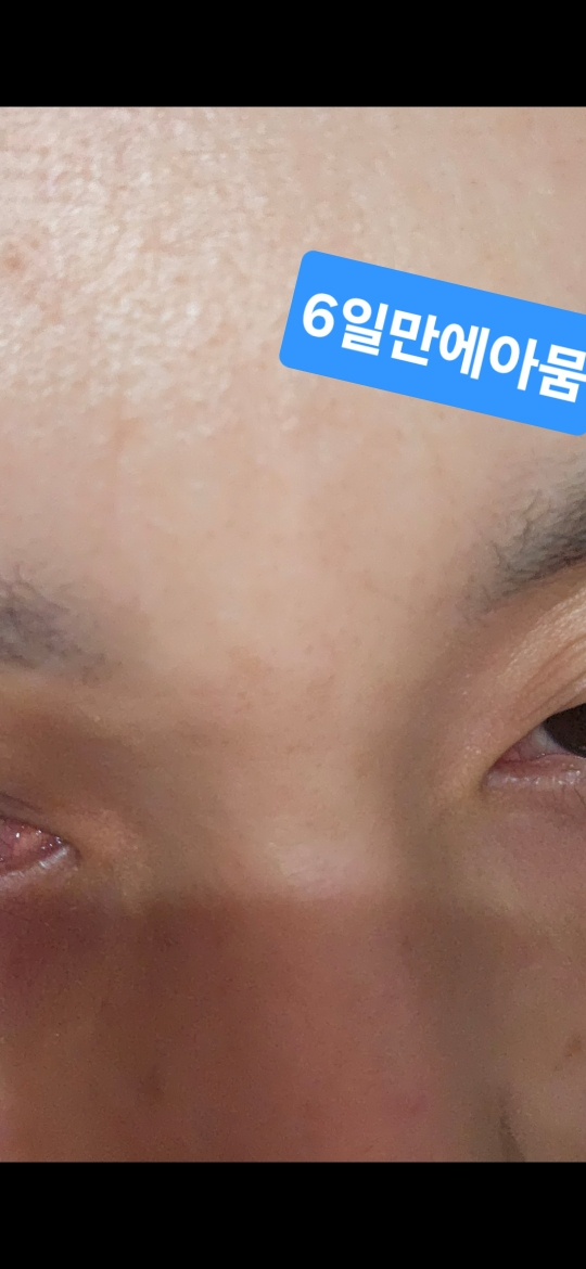 byeod-td 定点凸轮凝胶 common.review image