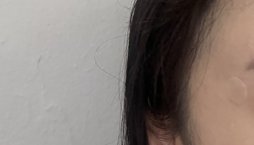 红斑护理贴片套装 [红斑］的真实用户使用照片