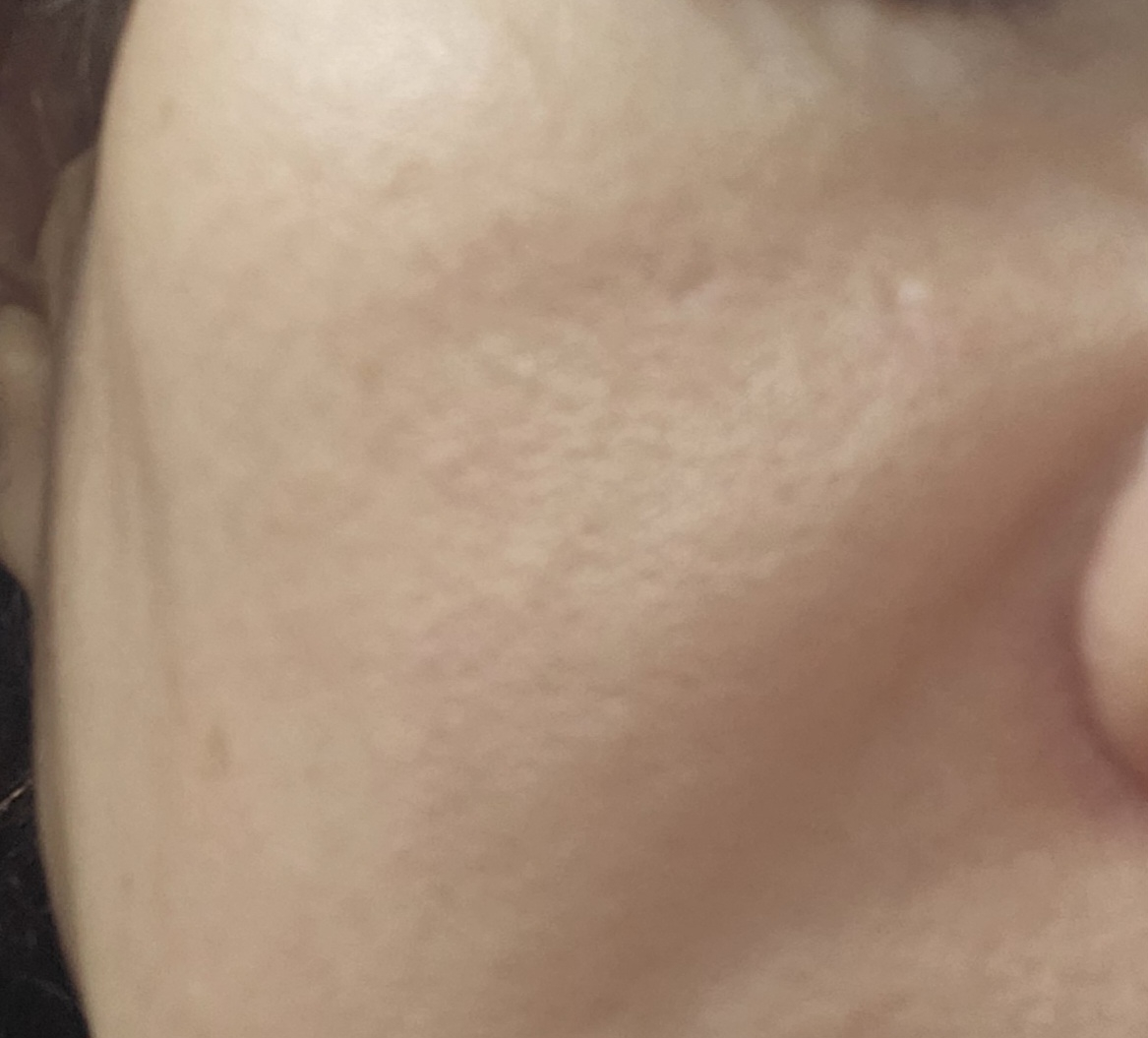 PDRN 粉红色一日精华液的真实用户使用照片