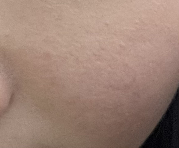 完美遮瑕三色盒 [03 Correct Up Beige] (Correct Up Beige)的真实用户使用照片