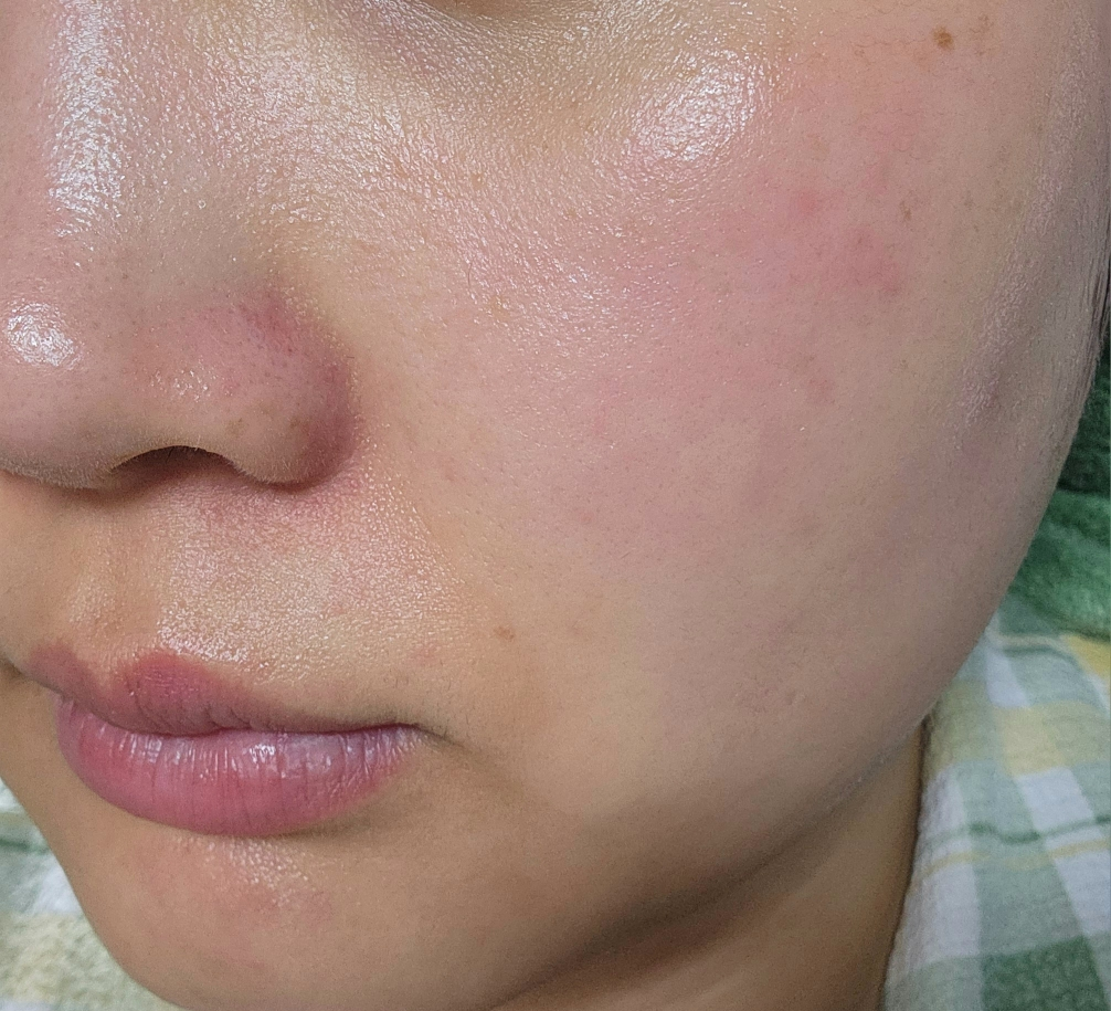 메이크프렘 (makep:rem) 히알 인테카 속수분 앰플 review image