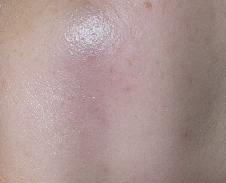 센텔리안24 (CENTELLIAN24) 마데카 분말 티트리 에이씨 review image