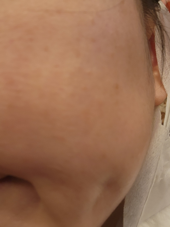 AXIS-Y 瑕疵护理焕彩精华液 common.review image