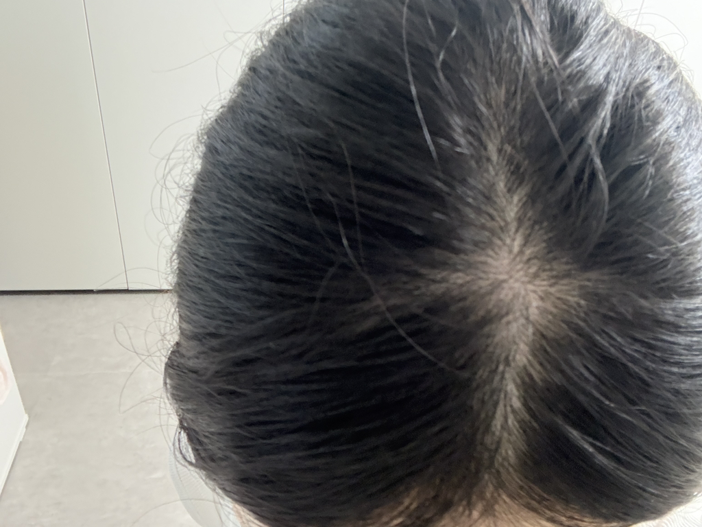 매터니티 스칼프 테라피 샴푸 review image