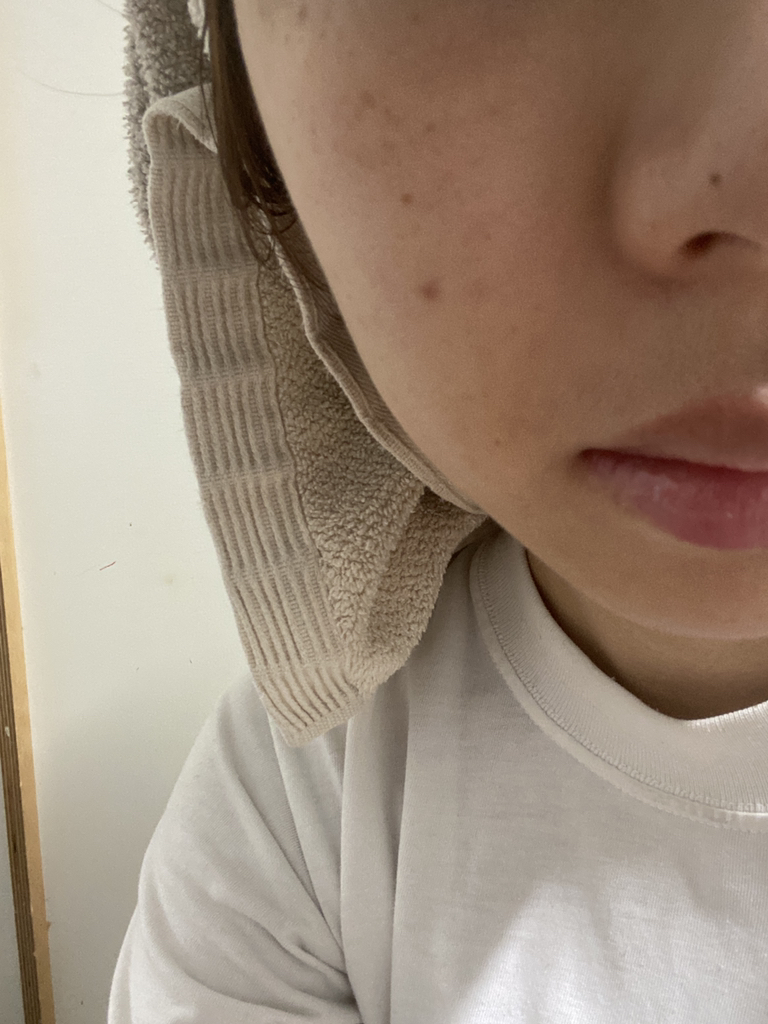 PDRN 玻尿酸胶囊 100 精华素面膜的真实用户使用照片