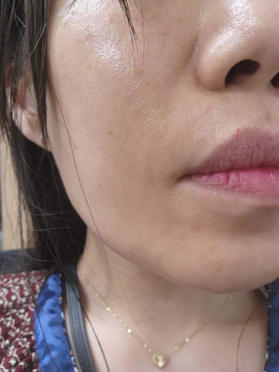 美迪惠尔 Dermaplus 面膜[低分子量透明质酸］ common.review image