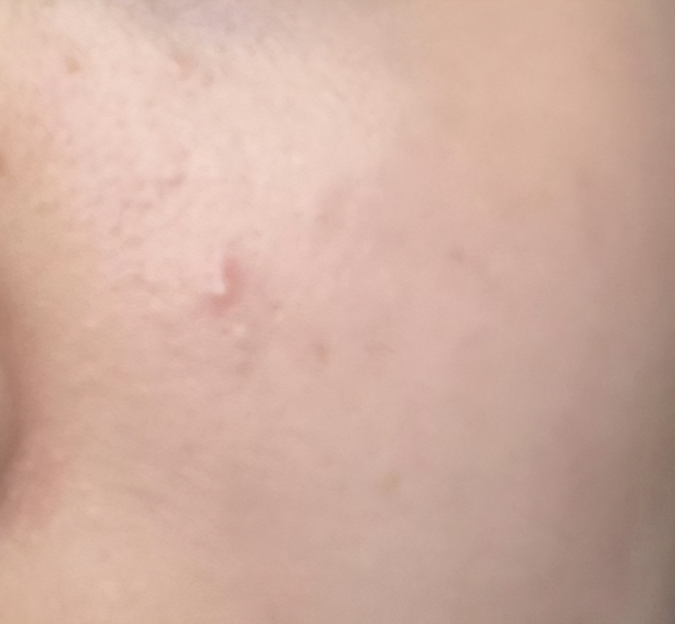 브이티코스메틱 (VTCOSMETICS) 시카 카밍 토너 review image