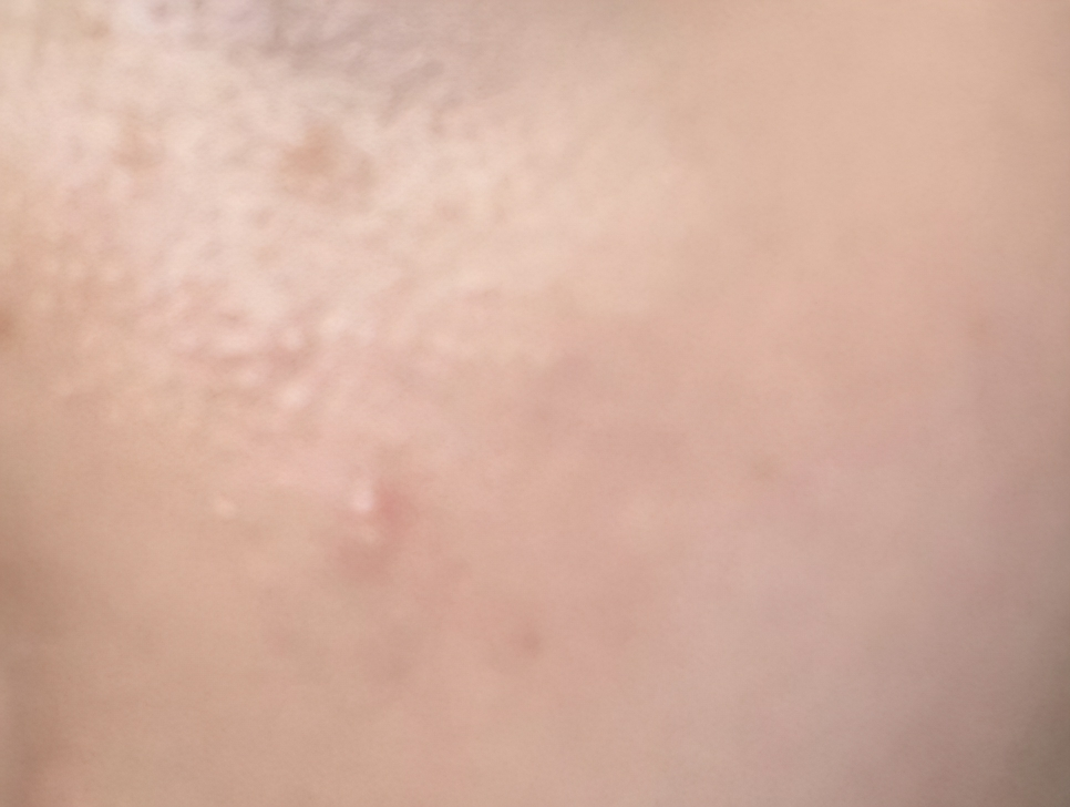 브이티코스메틱 (VTCOSMETICS) 시카 카밍 토너 review image