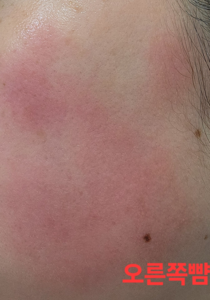 에드뷰 (EDVIEW) 발효 영양크림 review image