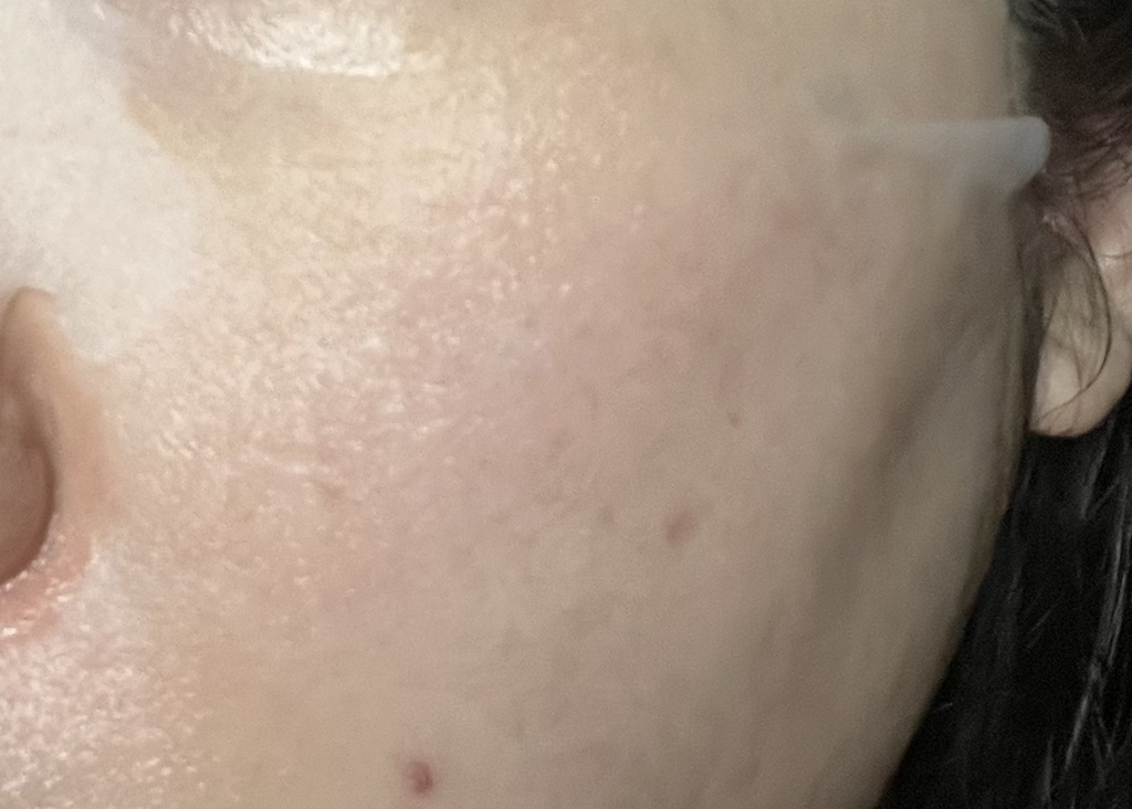 松树舒缓西卡强化霜的真实用户使用照片