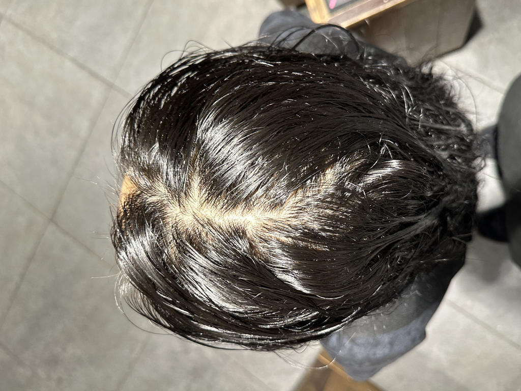 细胞因子促进剂 [SensitiveCare］的真实用户使用照片