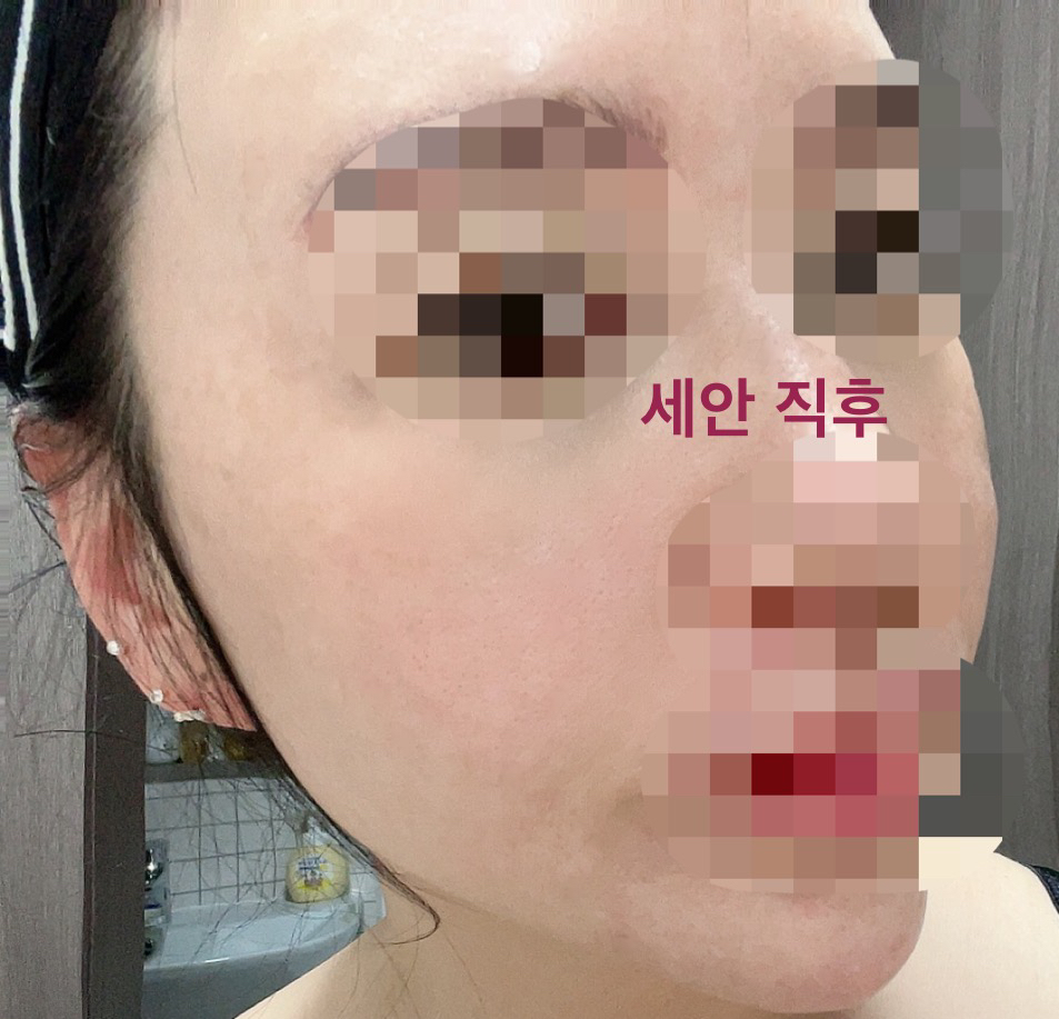 프리메라 (primera) 마일드 앤 퍼펙트 페이셜 필링 review image