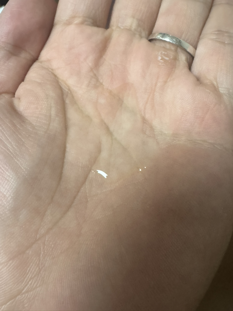 PhyDialene 100 玻尿酸增效爽肤水的真实用户使用照片