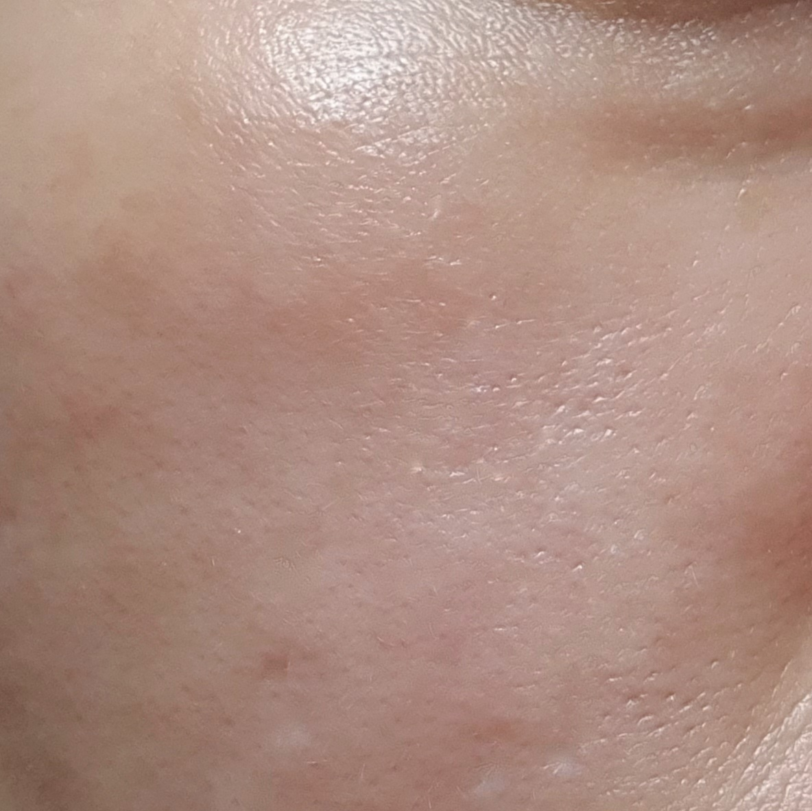 닥터오라클 (Dr.Oracle) 나이아브라이트™ 미백 앰플 review image