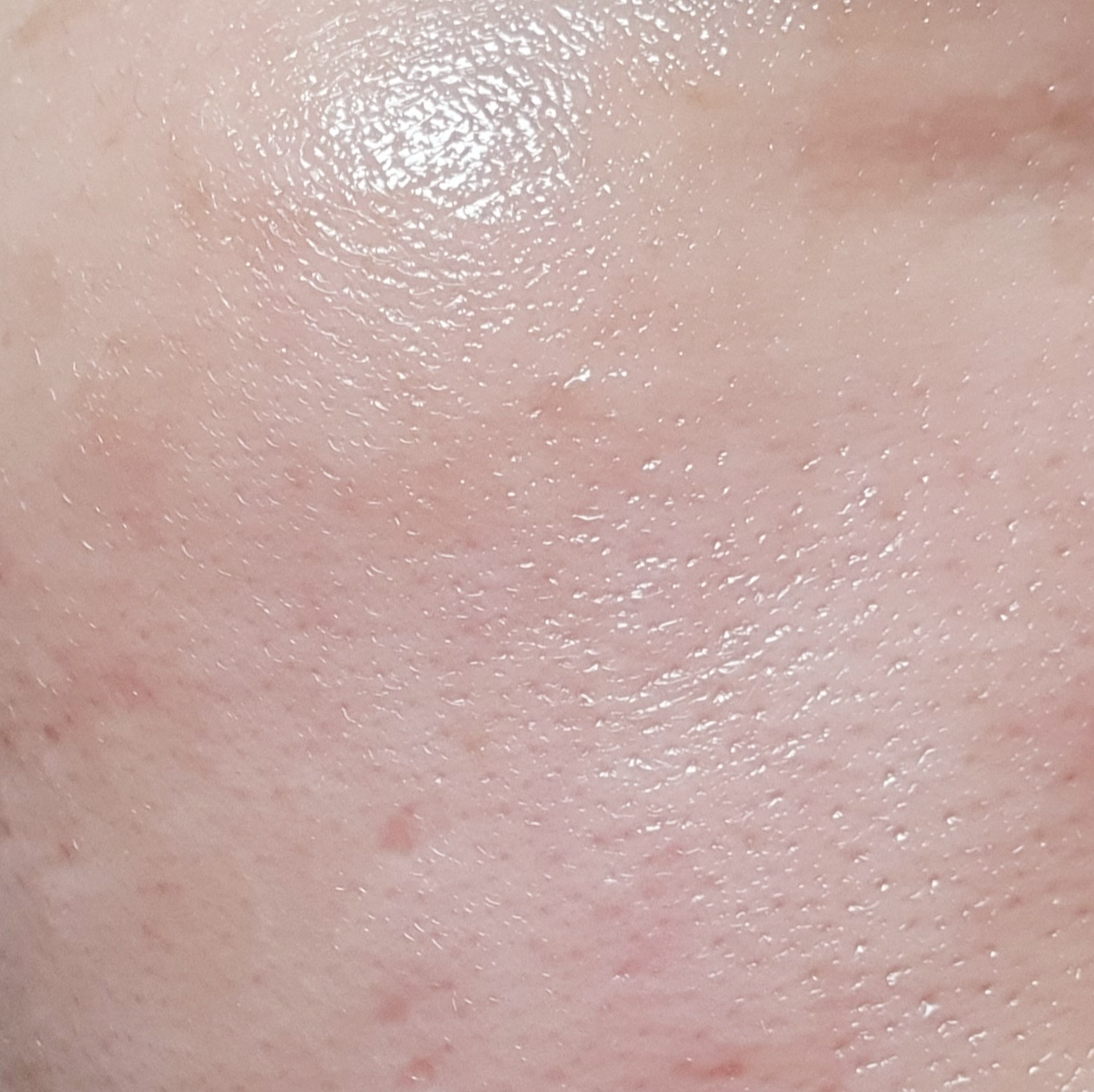 닥터오라클 (Dr.Oracle) 나이아브라이트™ 미백 앰플 review image