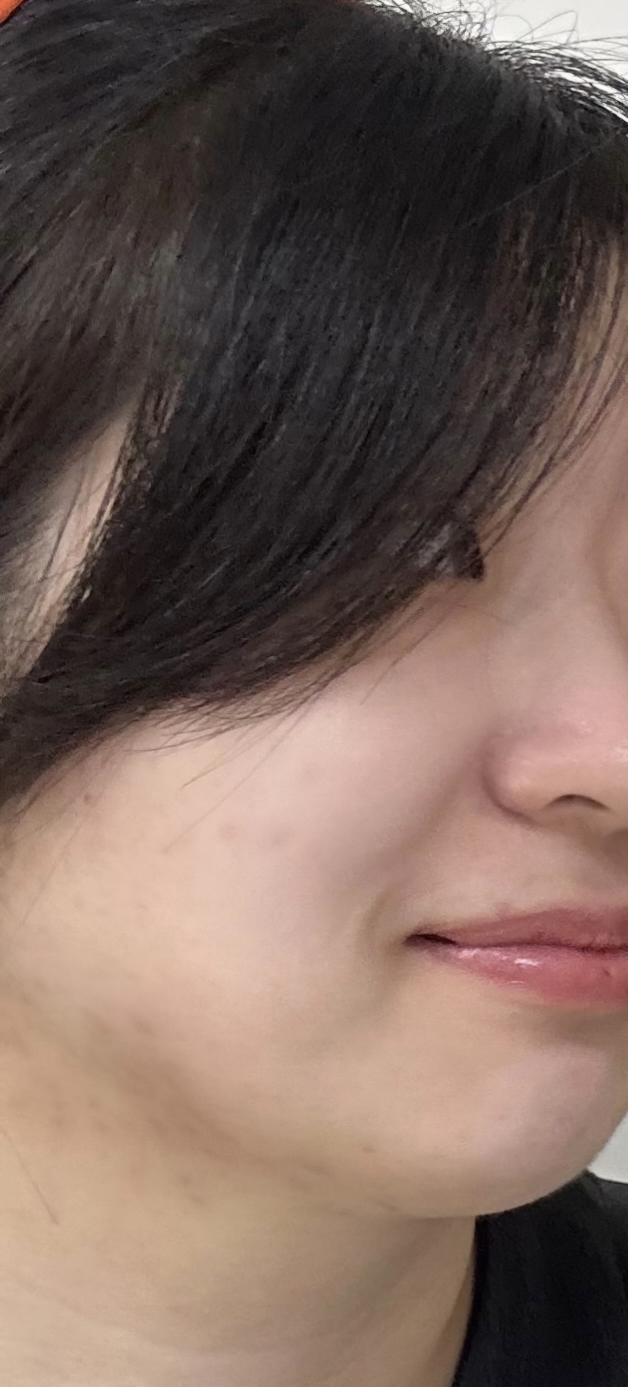 Ảnh đánh giá thực tế của người dùng về Terakne 365 Active Serum