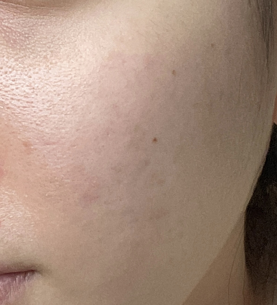 木瓜蛋白酶舒缓面膜的真实用户使用照片