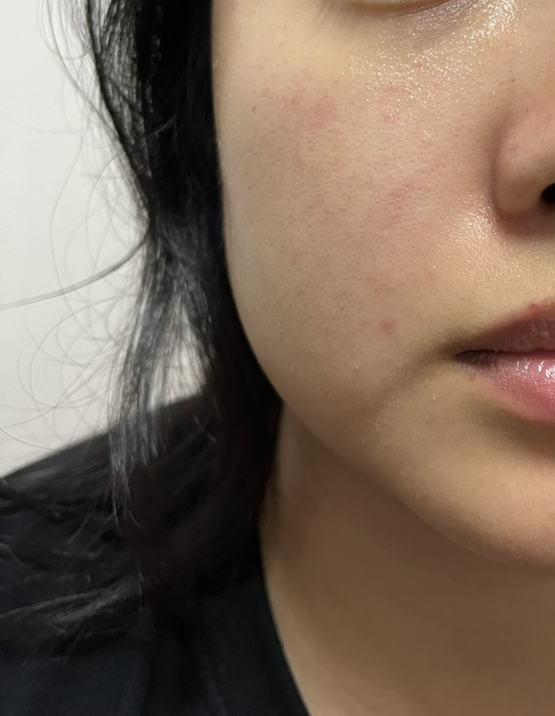 美蒂秋芙 单日外泌体射孔安瓿 2000 common.review image