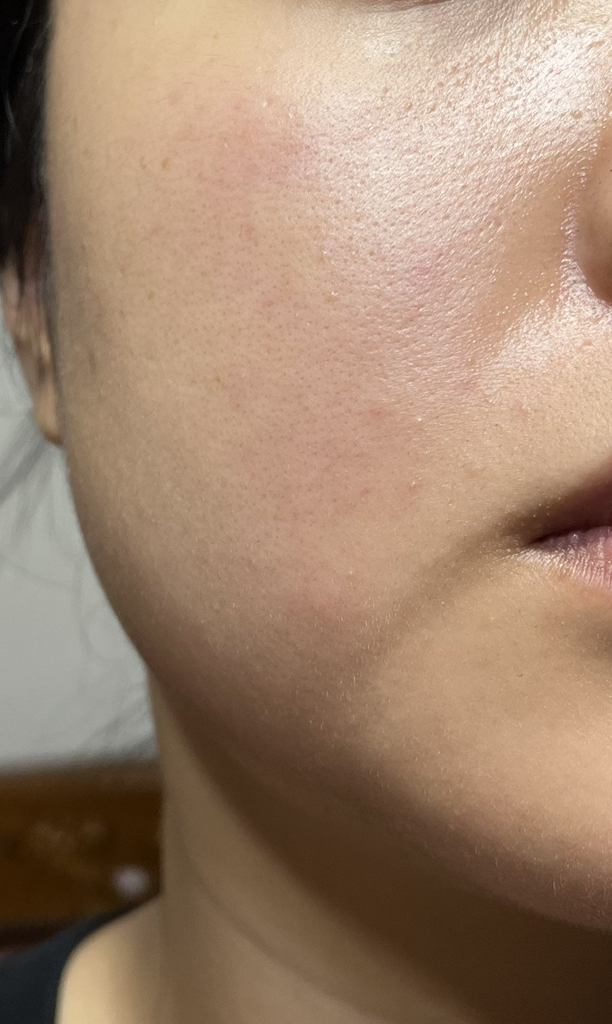 美蒂秋芙 单日外泌体射孔安瓿 2000 common.review image