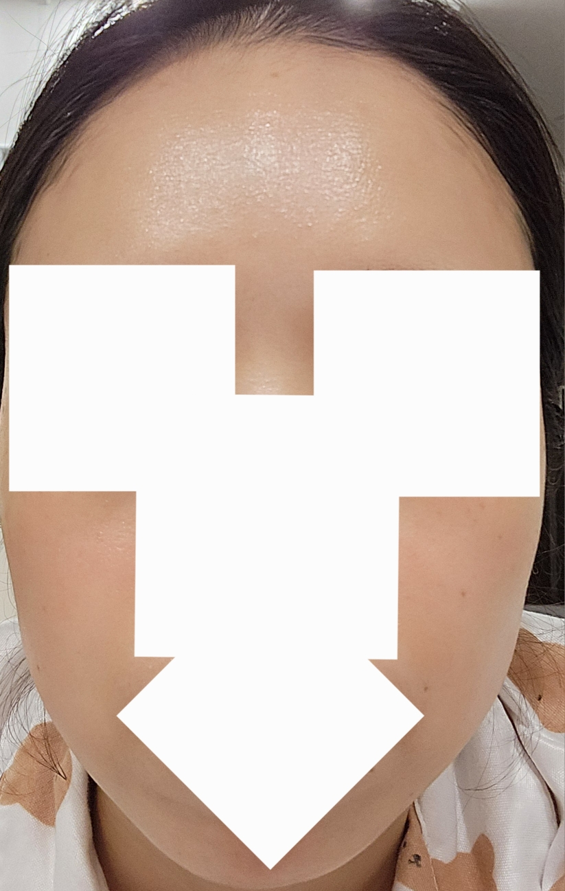 브이티코스메틱 (VTCOSMETICS) PDRN 광채시트마스크 review image