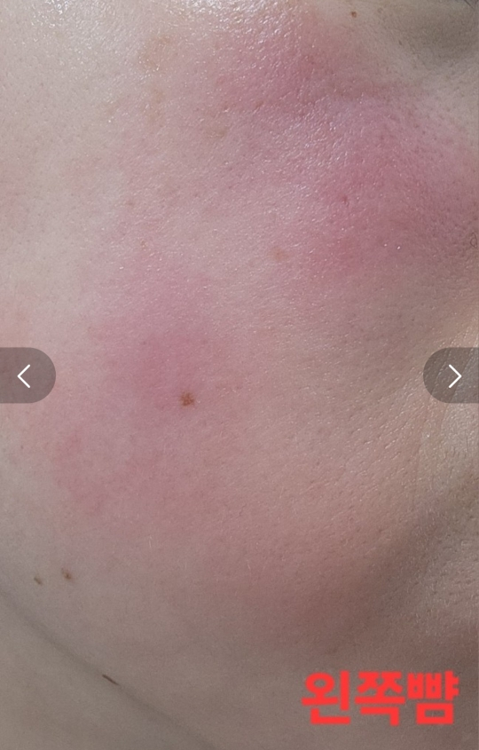 브이티코스메틱 (VTCOSMETICS) PDRN 광채시트마스크 review image