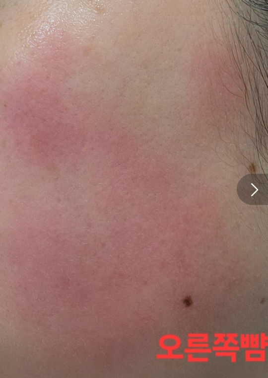 브이티코스메틱 (VTCOSMETICS) PDRN 광채시트마스크 review image