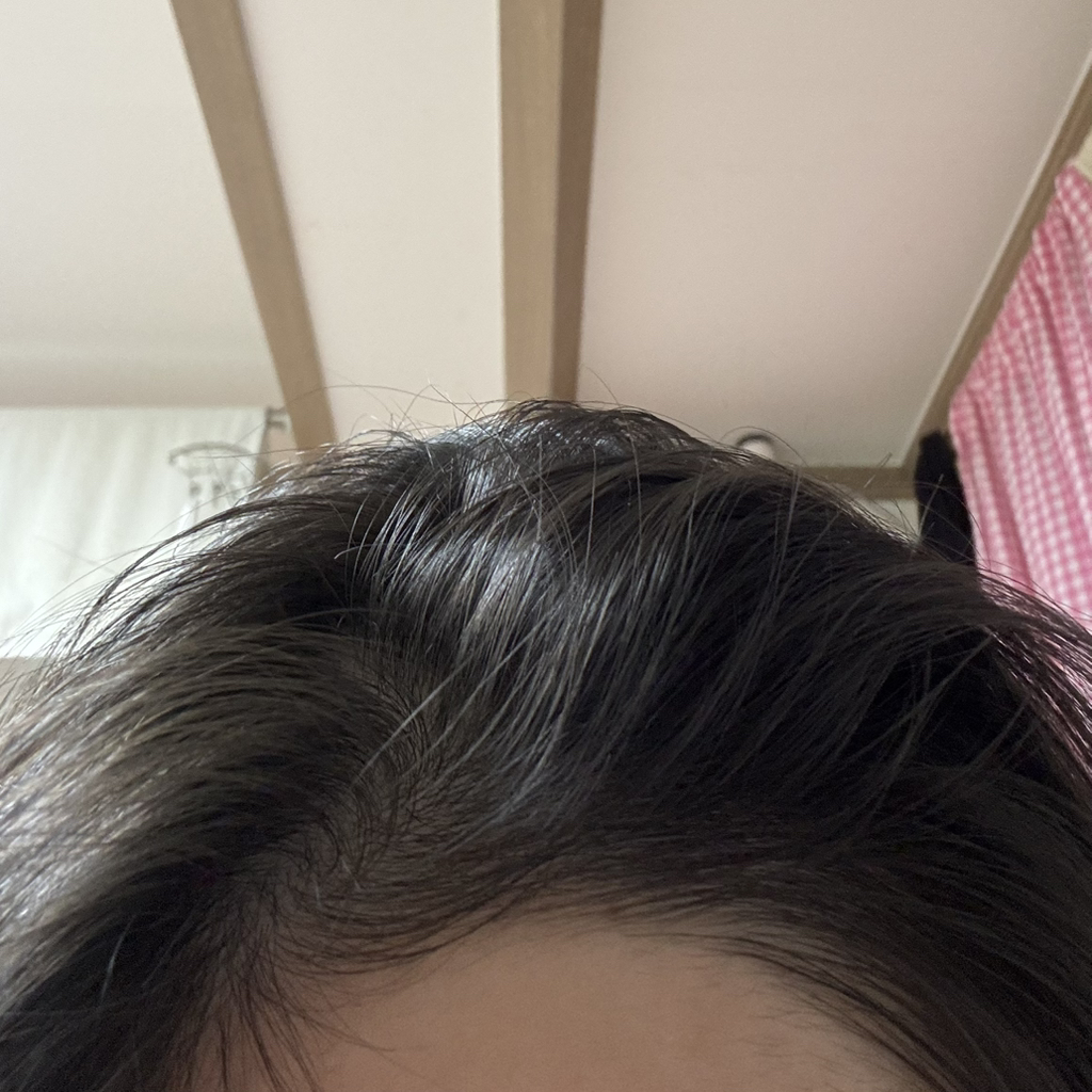 스팀베이스 (STEAMBASE) 티트리 스칼프 힐링 토닉 review image