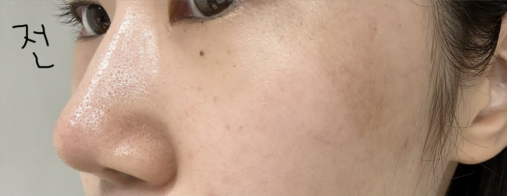 碧缓 冬青罗勒泡泡深层面膜 common.review image